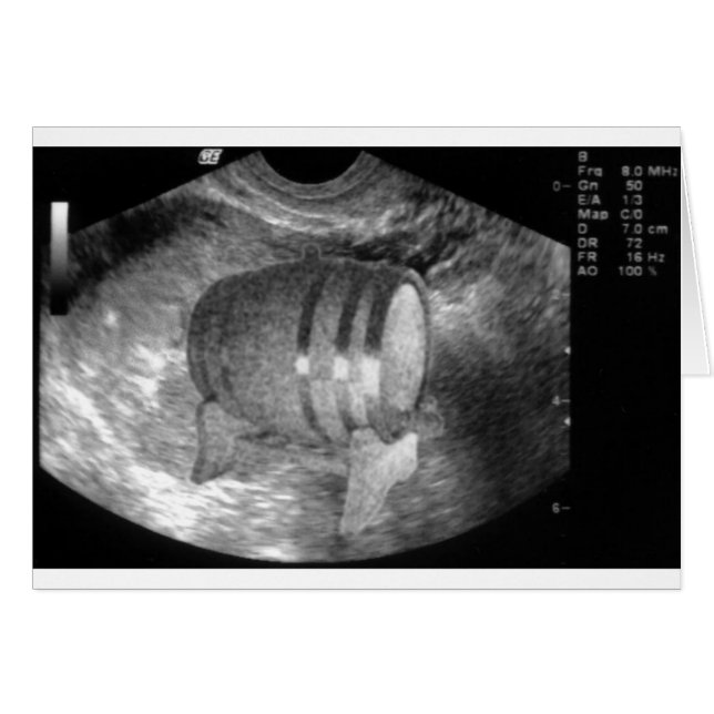 Guy's Card (Voorkant Horizontaal)