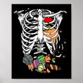 Halloween Snoep Skeleton Rib Cage X-Ray Poster (Voorkant)