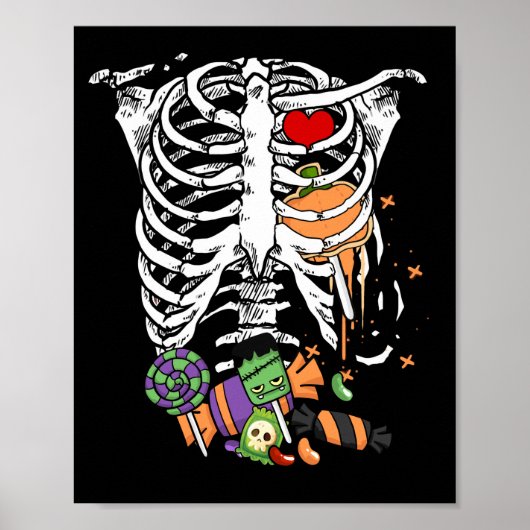 Halloween Snoep Skeleton Rib Cage X-Ray Poster (Voorkant)