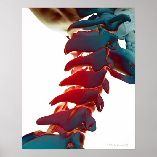 Hals Botten Poster (Voorkant)