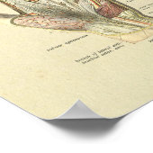 Hand Arteries Veins Nerves Anatomy Print (Hoek)