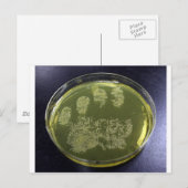 Hand Petri Dish Bacteria Briefkaart (Voorkant / Achterkant)