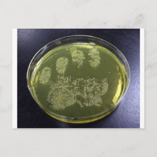 Hand Petri Dish Bacteria Briefkaart