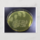 Hand Petri Dish Bacteria Briefkaart (Voorkant)