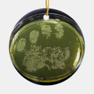 Hand Petri Dish Bacteria Keramisch Ornament