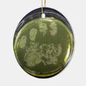 Hand Petri Dish Bacteria Keramisch Ornament (Links)