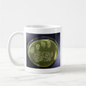 Hand Petri Dish Bacteria Koffiemok (Links)