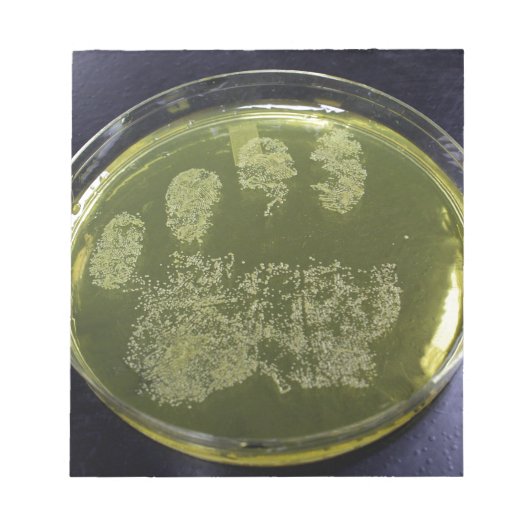 Hand Petri Dish Bacteria Notitieblok (Voorkant)