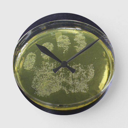 Hand Petri Dish Bacteria Ronde Klok (Voorkant)