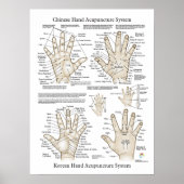 Handmatige Acupunctie Poster (Voorkant)