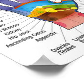 Handreflexologie 14x10 inch poster (Hoek)