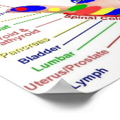 Handreflexologie 22x12 inch poster (Hoek)