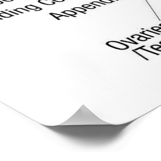 Handreflexologie 36 x 24 inch poster (Hoek)