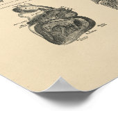  Harde Lung Anatomy 1880 Afdrukken Poster (Hoek)