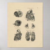  Harde Lung Anatomy 1880 Afdrukken Poster (Voorkant)