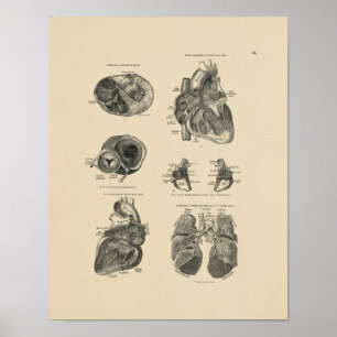  Harde Lung Anatomy 1880 Afdrukken Poster