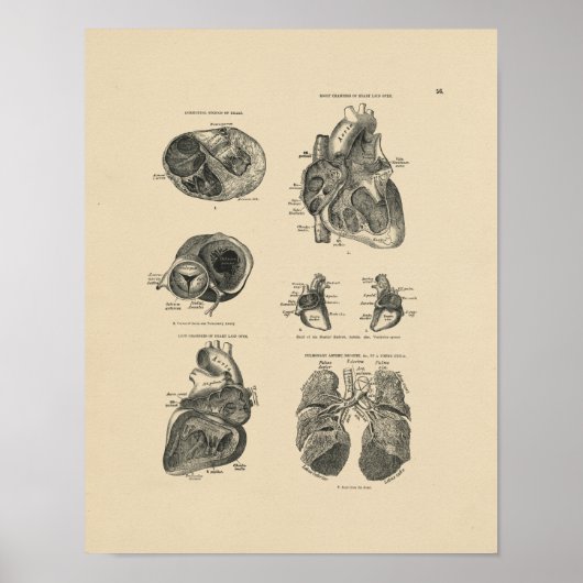 Harde Lung Anatomy 1880 Afdrukken Poster (Voorkant)