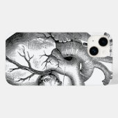  hartanatomie |  Case-Mate iPhone case (Achterkant (horizontaal))