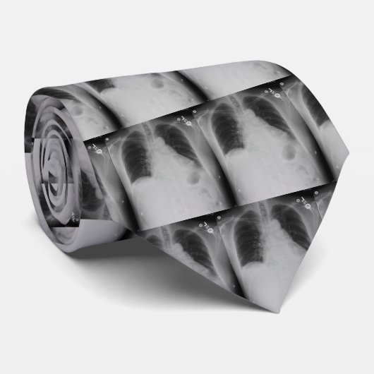 Hartchirurgie ~ stropdas (Opgerold)