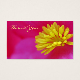 Hartelijk dank voor de lagere macro visitekaartje