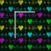 Hartritme irdescent ECG. Arts Stof (Delen)