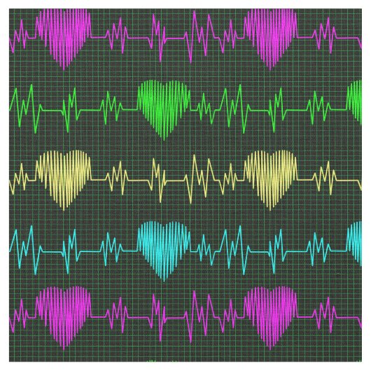 Hartritme irdescent ECG. Arts Stof (Close Up)