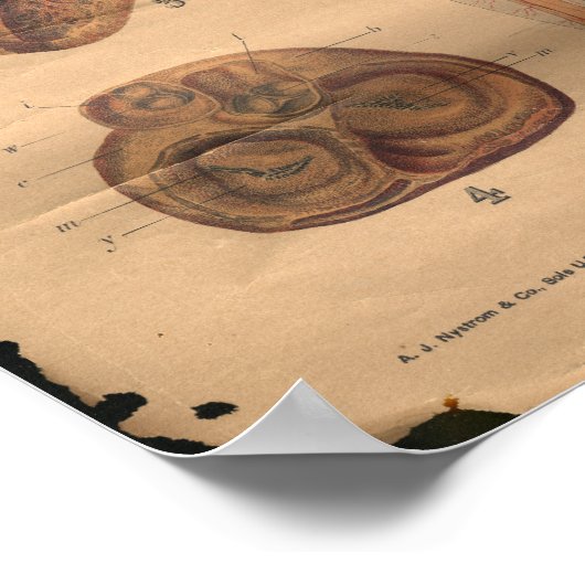  hartsterkten Anatomie Grafiek 1906 Poster (Hoek)