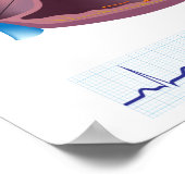 Hartziekte atriale fibrilleren Poster (Hoek)