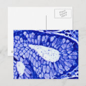 Helicobacter Pylori Briefkaart (Voorkant / Achterkant)