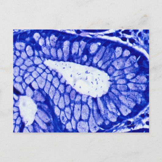 Helicobacter Pylori Briefkaart (Voorkant)