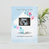 Hemelblauw en ultrasone Baby foto met omlijsting Aankondiging (Staand voorkant)