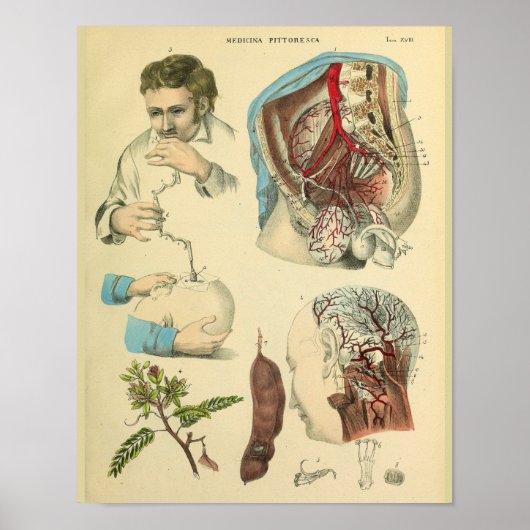 Hersenchirurgie Hoofd Anatomie Kunstdokter Afdrukk Poster (Voorkant)