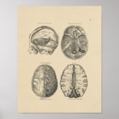 hersenschedel Anatomie 1880 Afdruk Poster (Voorkant)