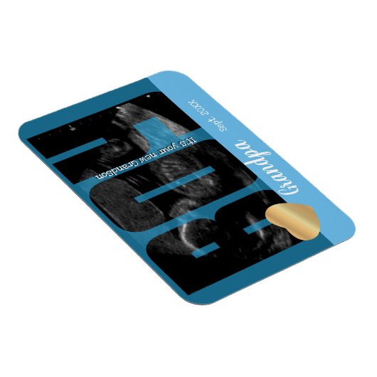 Het is een Jongen Aankondiging - Sonogram met ZY T Magneet (Rechterzijde)