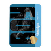 Het is een Jongen Aankondiging - Sonogram met ZY T Magneet (Verticaal)