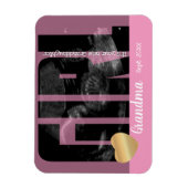 Het is een meisjesaankondiging - Sonogram met ZY-t Magneet (Verticaal)