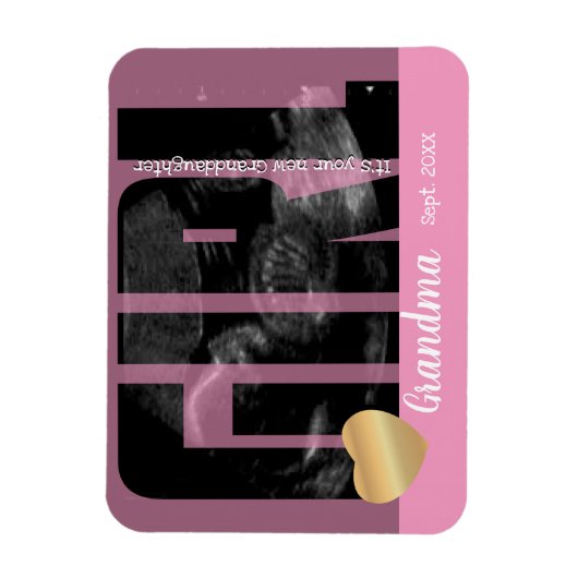 Het is een meisjesaankondiging - Sonogram met ZY-t Magneet (Verticaal)