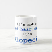 Het is geen slechte haardag, het is Alopecia. Koffiemok (Center)