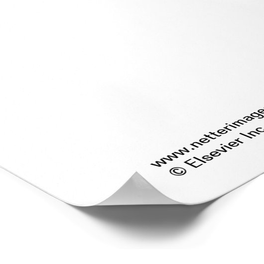 Het Pelvic Floor Poster (Hoek)