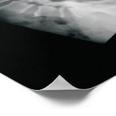 Het Poster Chiropractor Movie (Hoek)