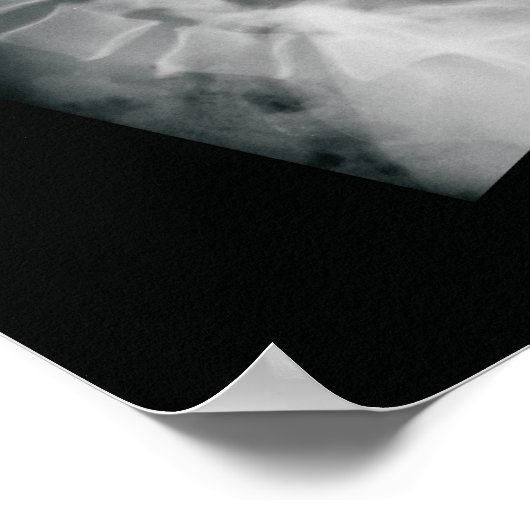 Het Poster Chiropractor Movie (Hoek)