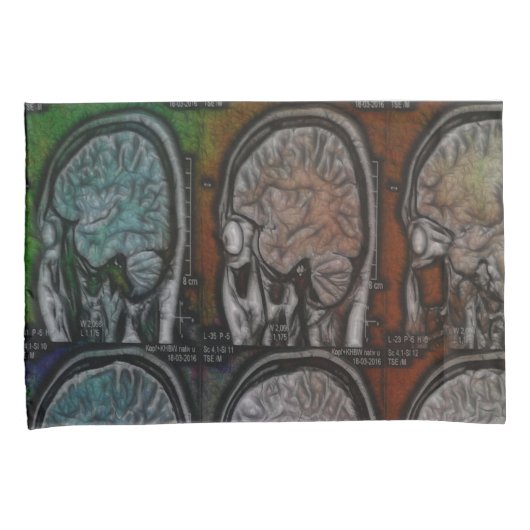 Het Roswell Archive Kussensloop (Voorkant-Rechts)