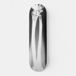 Het skateboard van Breaks van Bradley Boness