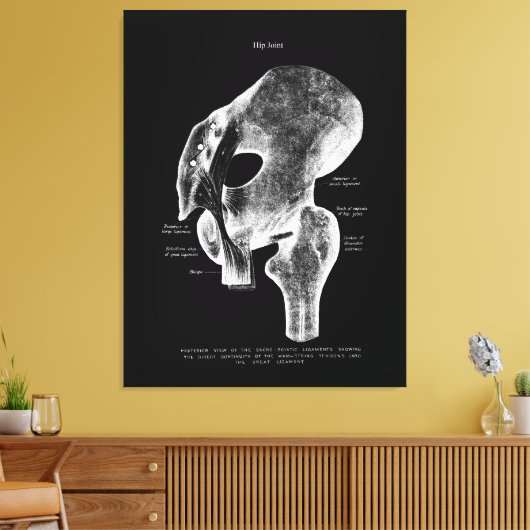 Heup Gewrichtsanatomie Medische Grote Canvaskunst Canvas Afdruk (Insitu (Woonkamer))
