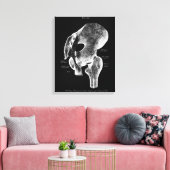 Heup Gewrichtsanatomie Medische Grote Canvaskunst Canvas Afdruk (Insitu (Woonkamer))