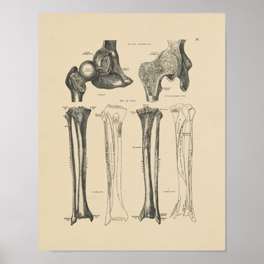 Heup Joint Anatomy 1880 Print (Voorkant)