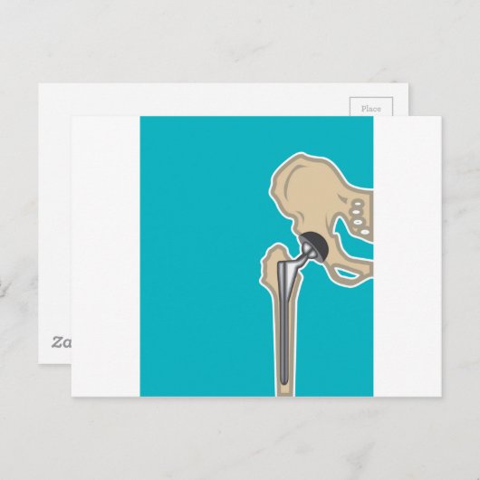 Heupgewrichtsvervanging Briefkaart (Voorkant / Achterkant)