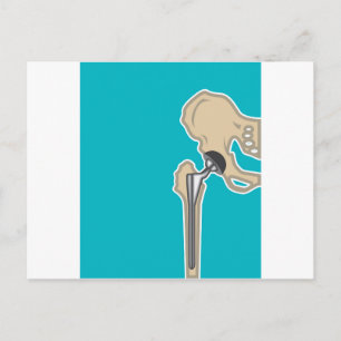 Heupgewrichtsvervanging Briefkaart