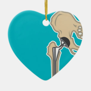 Heupgewrichtsvervanging Keramisch Ornament
