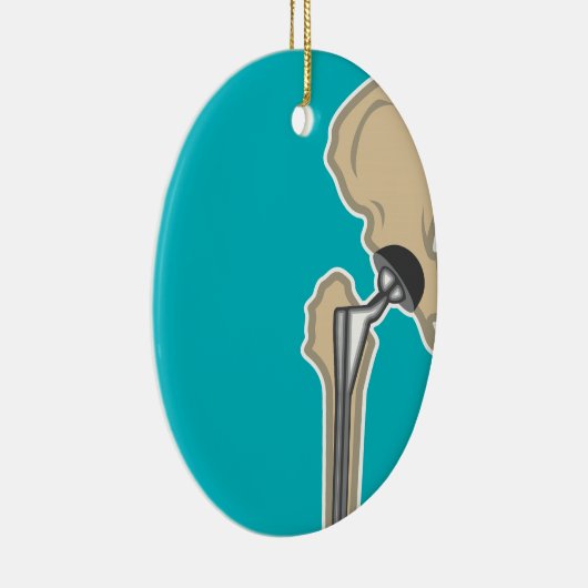 Heupgewrichtsvervanging Keramisch Ornament (Rechts)